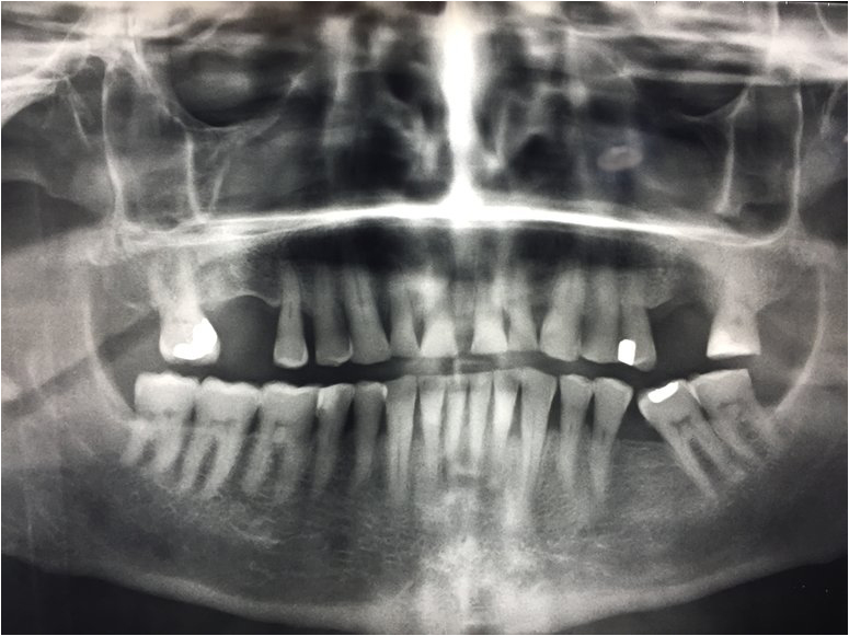 foto Dentalpunt