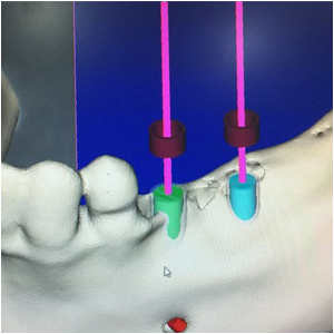 foto Dentalpunt