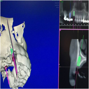 foto Dentalpunt