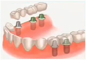 foto Dentalpunt