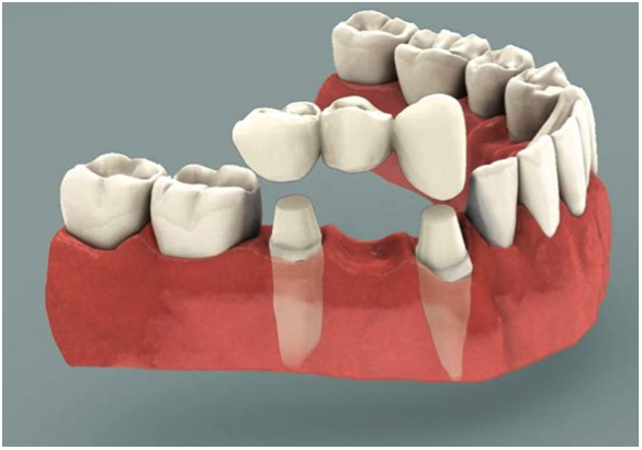 foto Dentalpunt